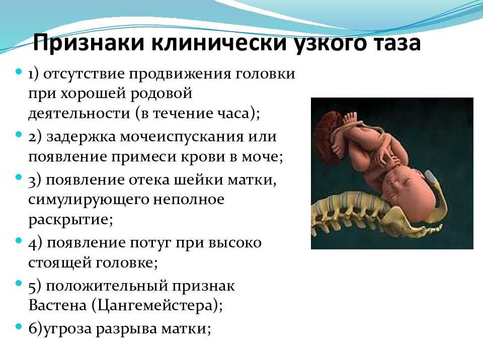 Размеры таза при беременности: нормы (таблица) и отклонения - spuzom.com