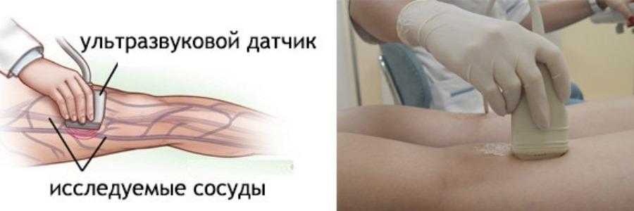 Уздс и уздг — в чем разница и особенности проведения?