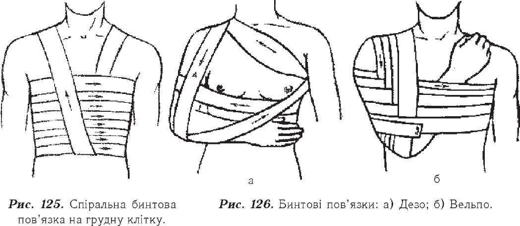 Перелом ключицы: симптомы, последствия, первая помощь