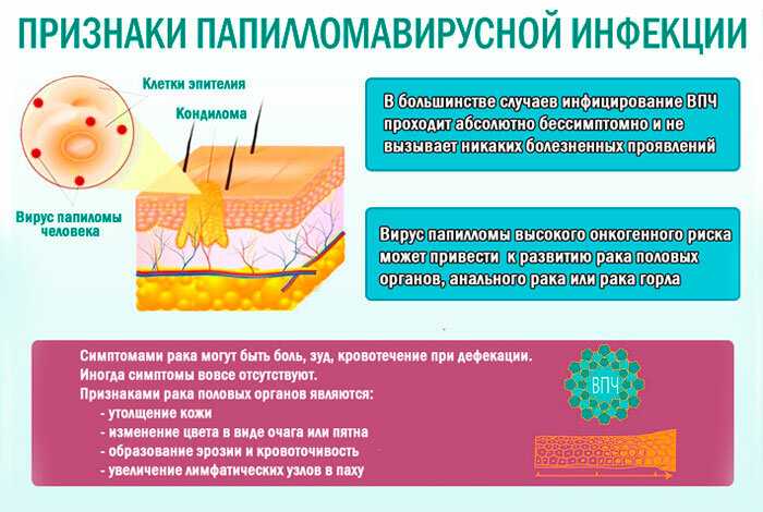 Вирус папилломы человека (впч)