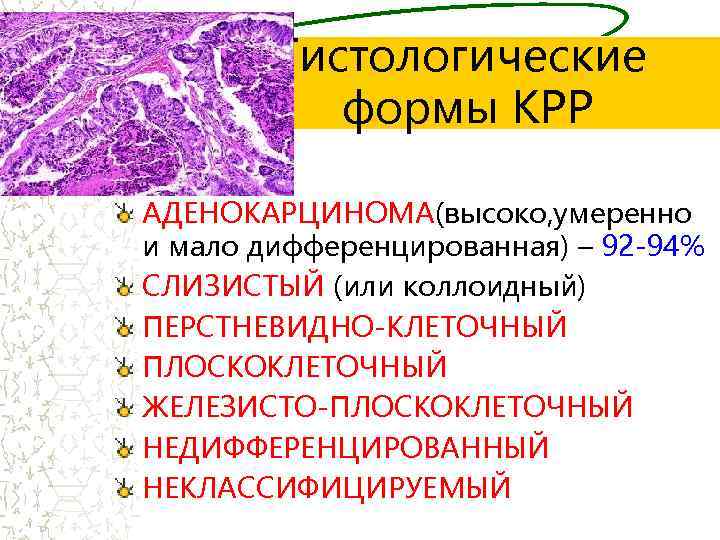 Низкодифференцированный рак - израильский онкологический центр
