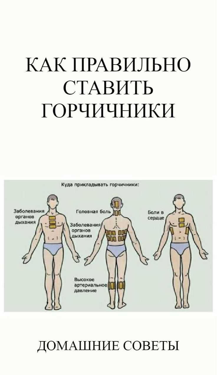 Как ставить горчичники при кашле: взрослому и ребенку, можно ли делать при бронхите, инструкция по применению, как правильно проводить процедуру