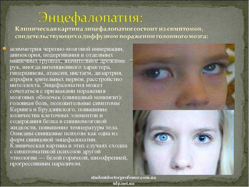 Аноксическое поражение головного мозга - что это