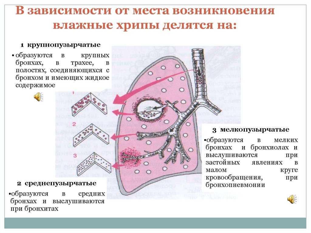 Первые признаки пневмонии у детей, как их распознать и диагностировать