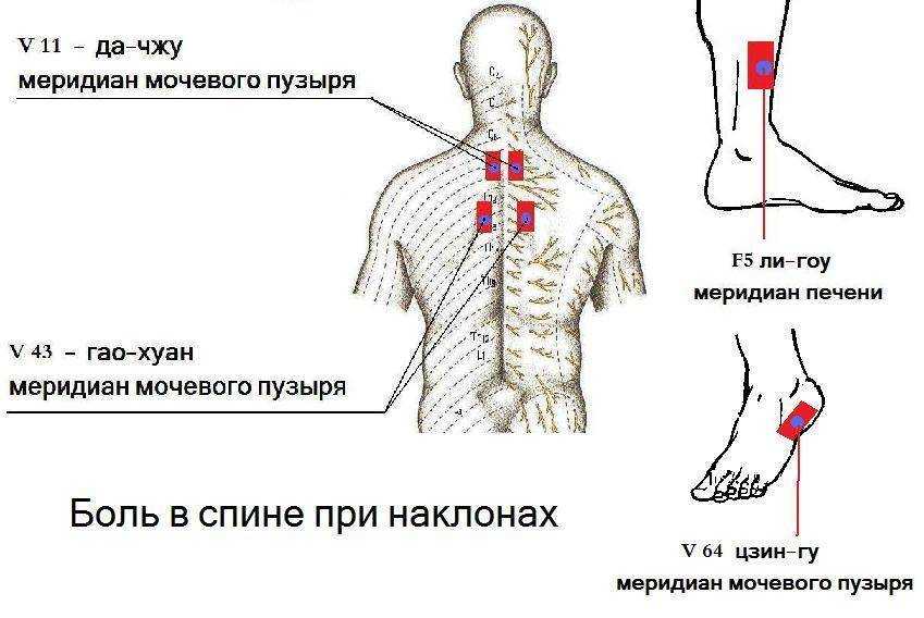 Болит спина, голова и шея – как возникает боль, причины, профилактика боли в спине и шее