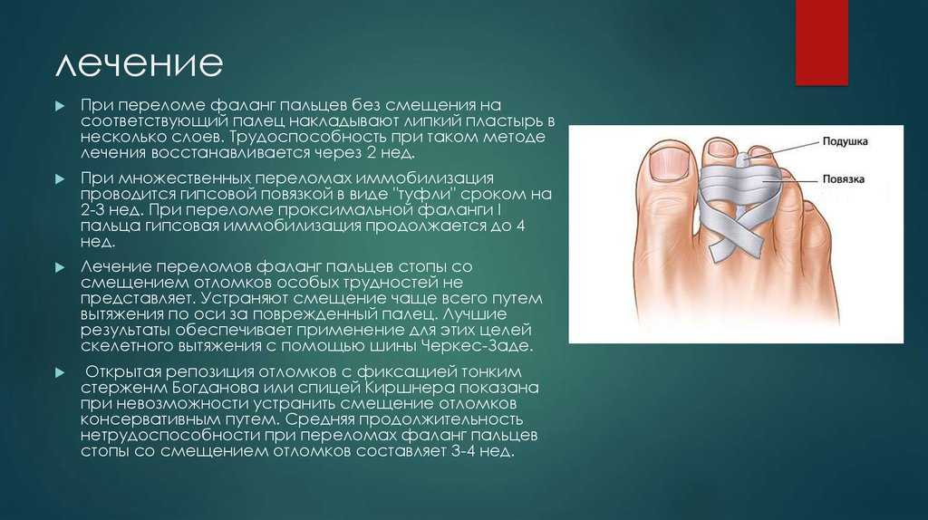 Сколько заживает перелом пальца на ноге без гипса
