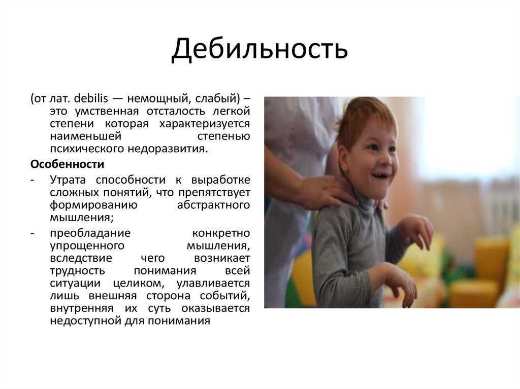 Олигофрения