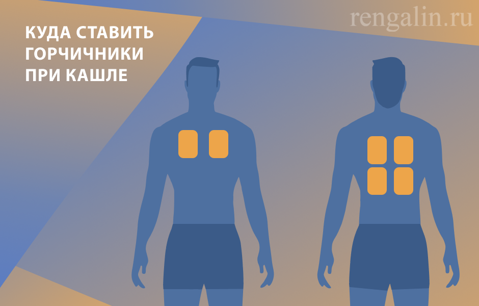 Как правильно ставить горчичники при сухом кашле: инструкция по применению - кашельoff
