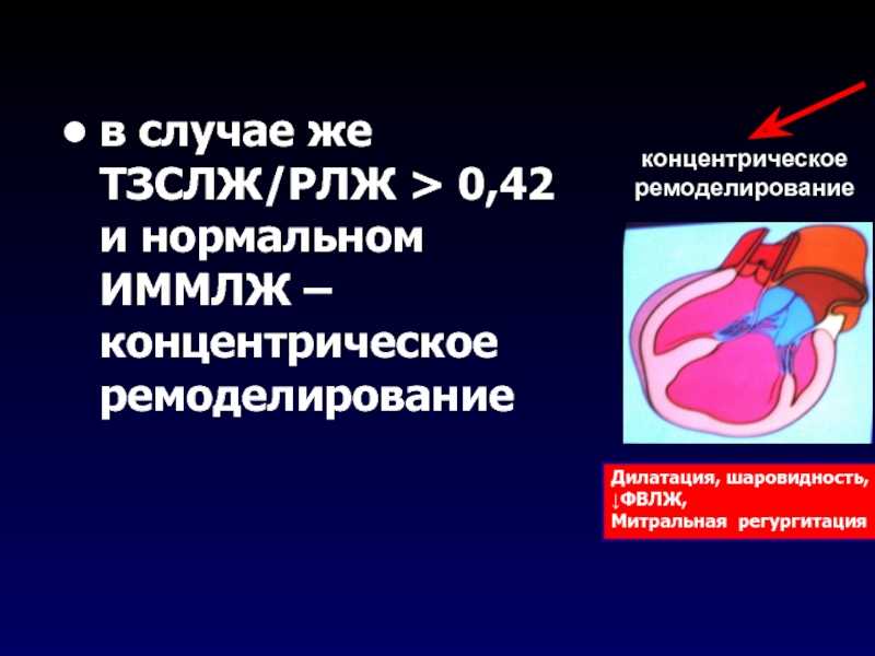 Ремоделирование сердца : статья : медицина, здоровье