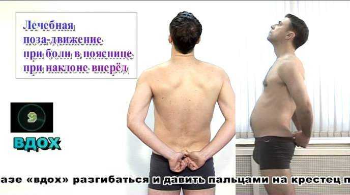 Боли между лопаток, отдает в шею: почему болит, что это, как лечить?