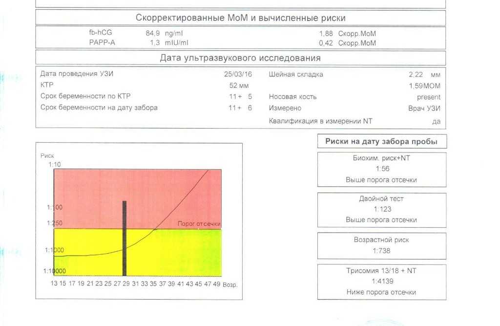 Скрининг при беременности: все об узи беременных * клиника диана в санкт-петербурге