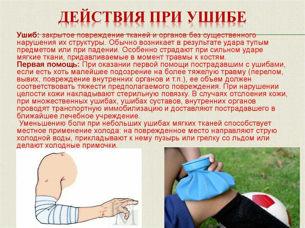 Ушиб кисти – причины, лечение и возможные осложнения