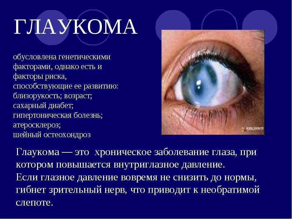 Глаукома: причины и проявления