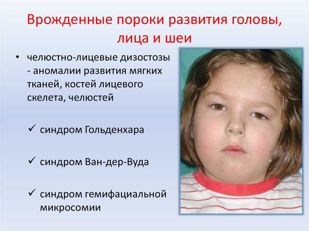 Впр плода - врожденные пороки развития: причины, диагностика, оптимальный срок для выявления