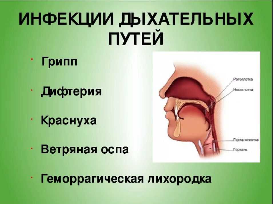 Инфекционные заболевания верхних дыхательных путей: причины, симптомы, лечение