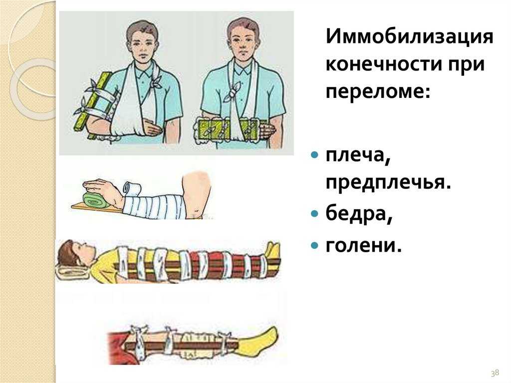 Наложение шины на сломанную конечность: алгоритм и правила