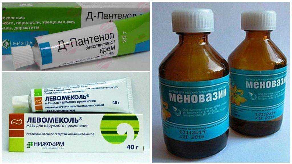Ферезол