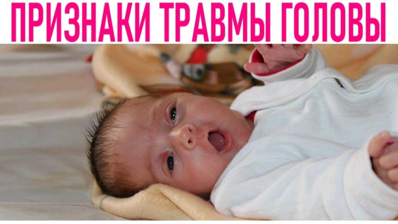 Ребенок ударился головой: на что обратить внимание
