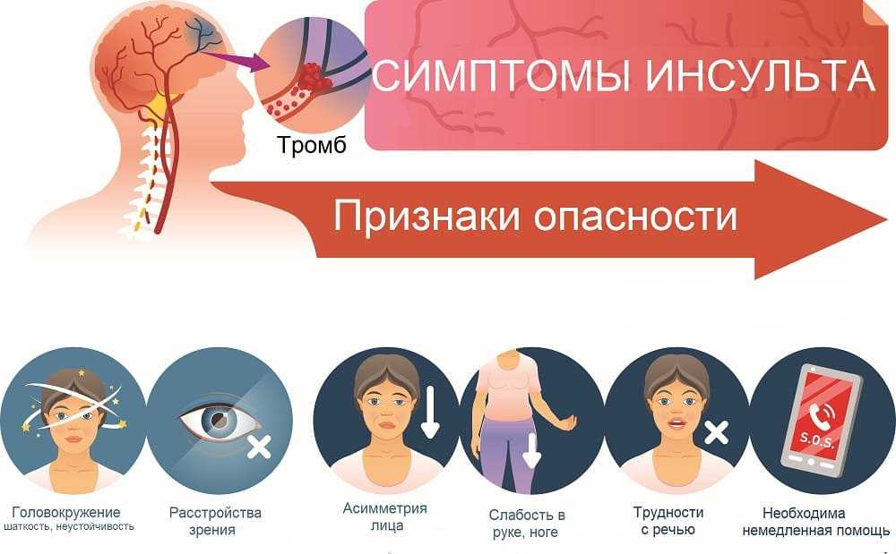 Головокружение при вставании и когда ложишься: причины и лечение