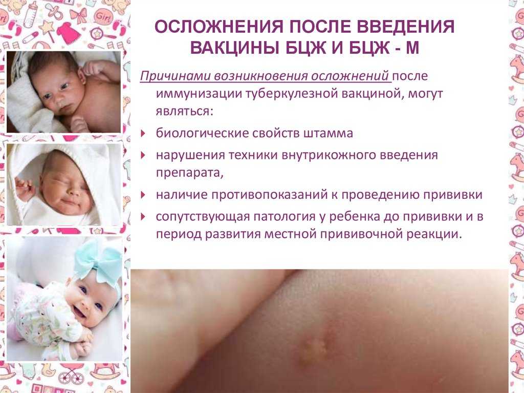 Реакция на прививку бцж