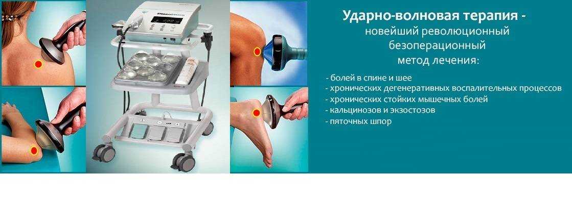 Ударно-волновая терапия