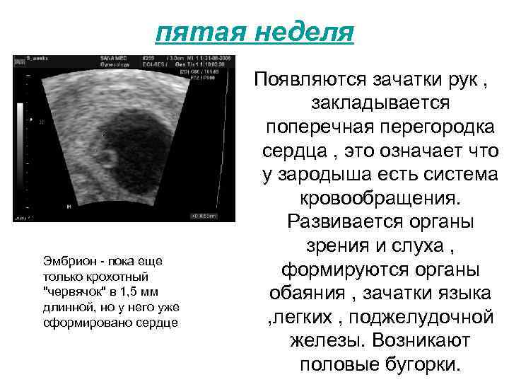 Плодное яйцо без эмбриона: что делать и почему это происходит?