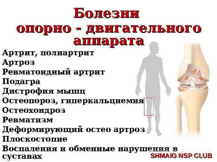 Заболевания опорно-двигательного аппарата: взгляд воз