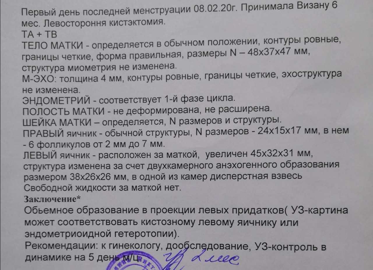 Киста яичника при беременности