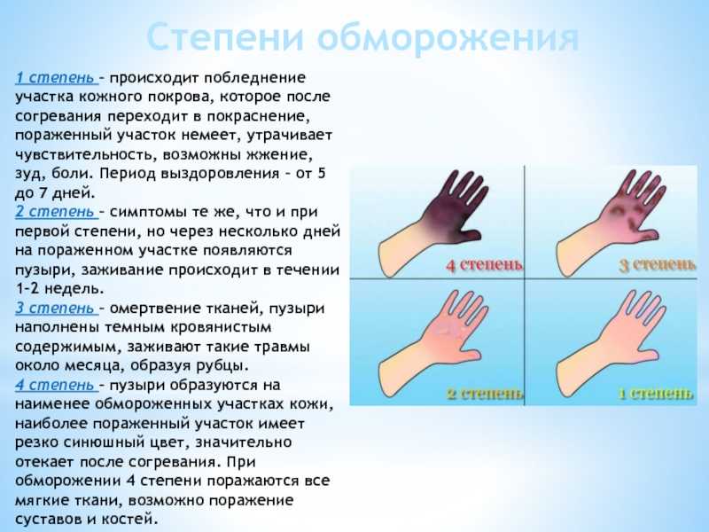 Осложнения после обморожения - медтело.ру