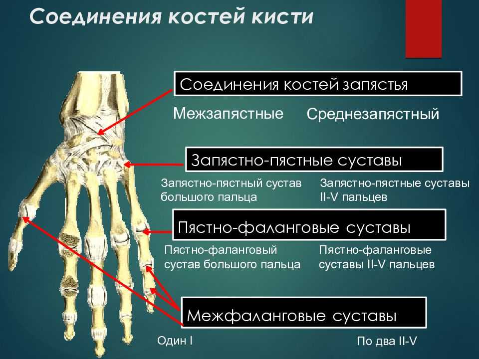 Пястно фаланговый сустав болит при