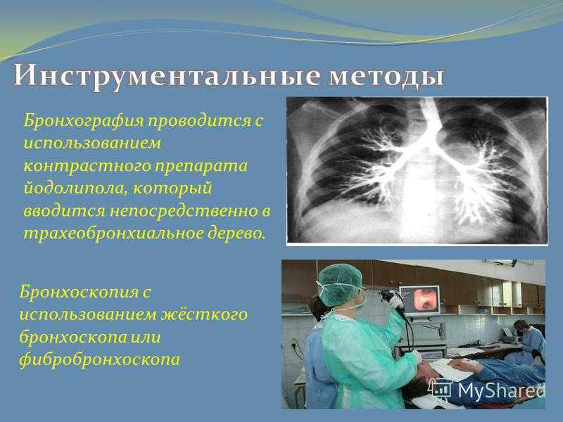 Бронхография