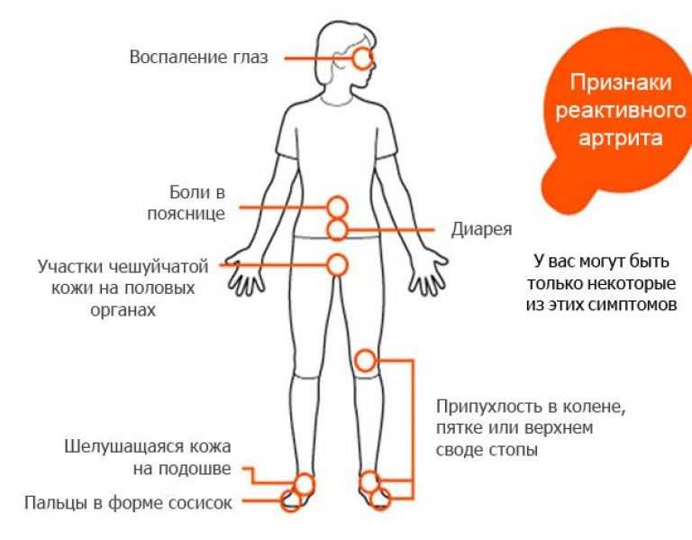 Какой врач лечит суставы - к кому обращаться при болях | zaslonovgrad.ru