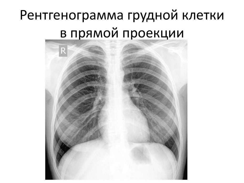 Рентген органов грудной клетки: что показывает, как часто можно делать, где сделать?