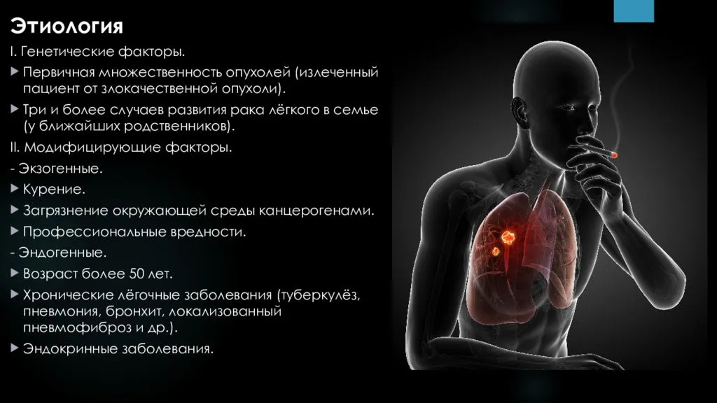 Лечение рака легких: стадии болезни и методы борьбы