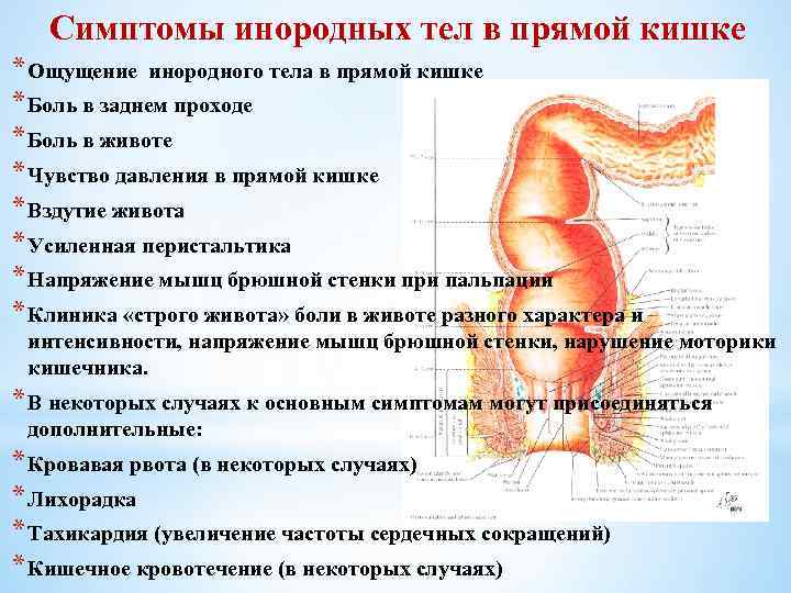 Боль в прямой кишке: резкая, пульсирующая, тянущая, ночная