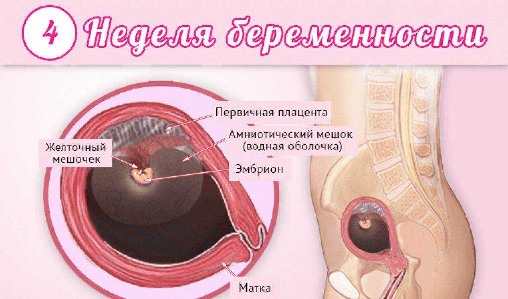 У З И на 4 неделе беременности  Узи на 4 неделе беременности  Обследование беременной женщины ультразвуковым методом стало обычной практикой, широко