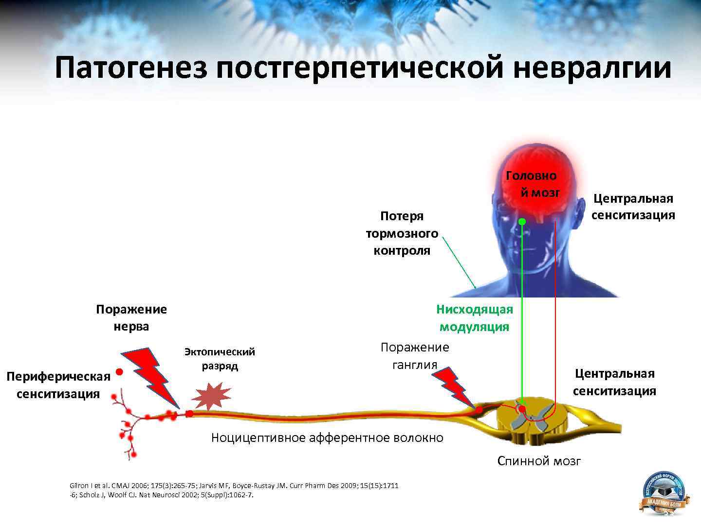 Опоясывающий лишай