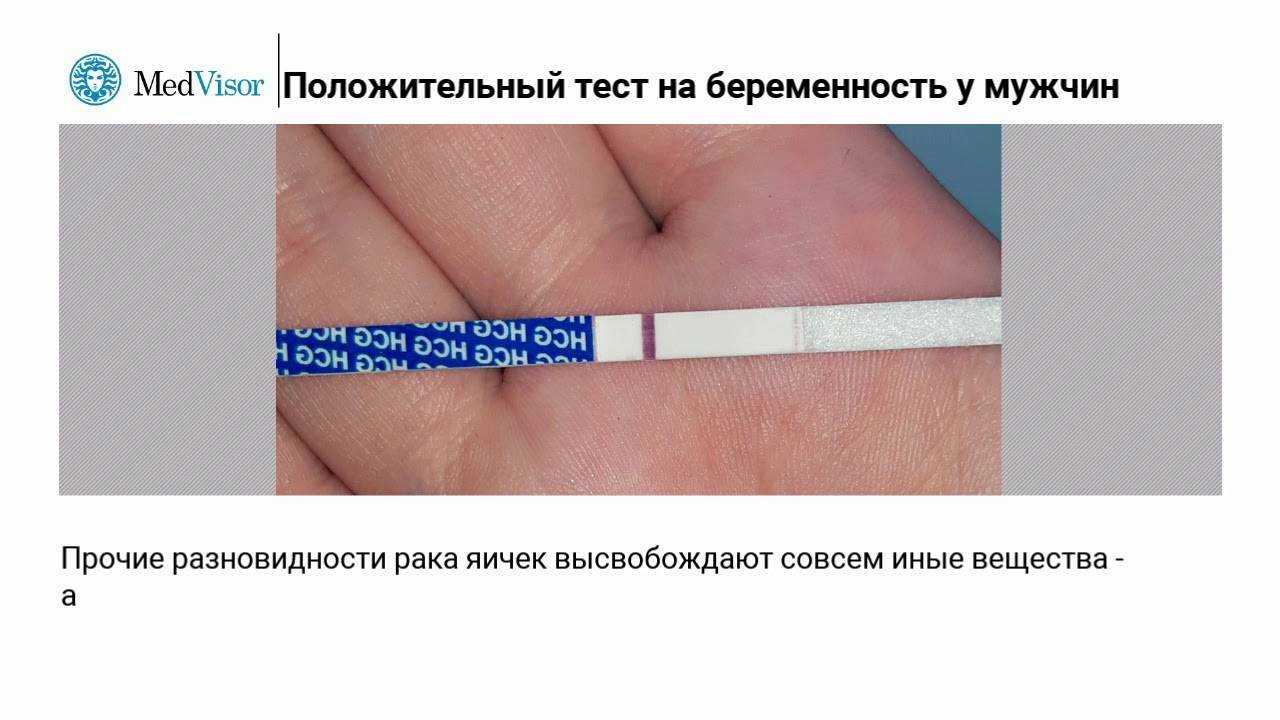 Из-за чего могут ошибаться тесты на беременность