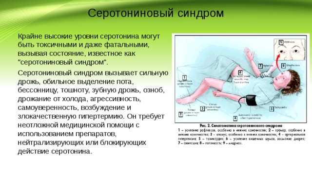 Серотониновый синдром - причины, симптомы, схемы лечения