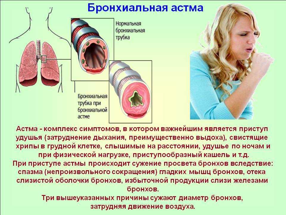 ᐈ что такое бронхоспазм? ~【первая помощь и лечение в киеве】