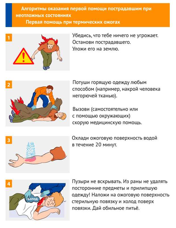 Оказание первой помощи при ожогах: по степеням и видам