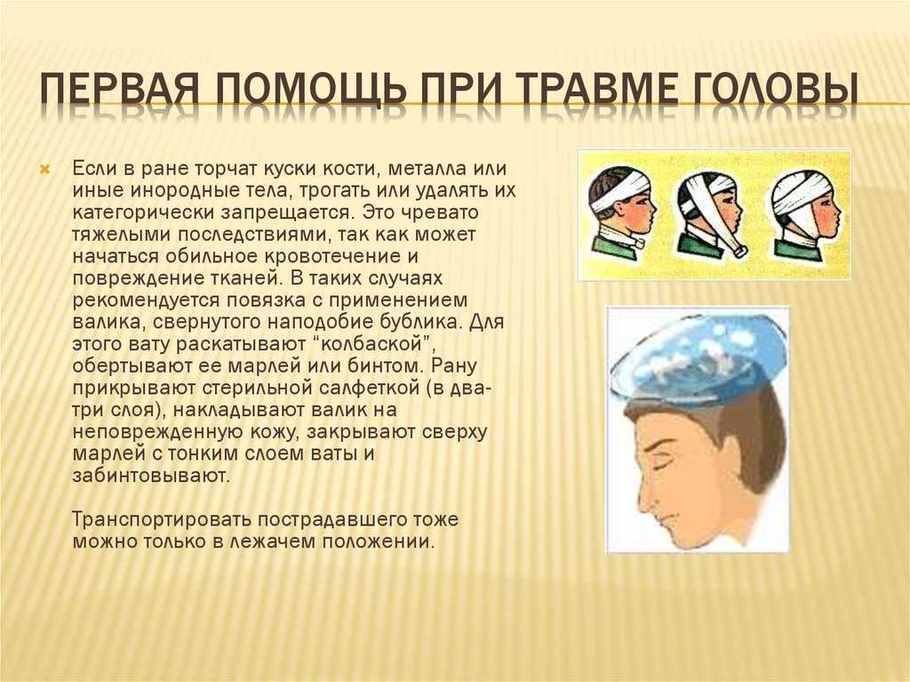 Сотрясение мозга