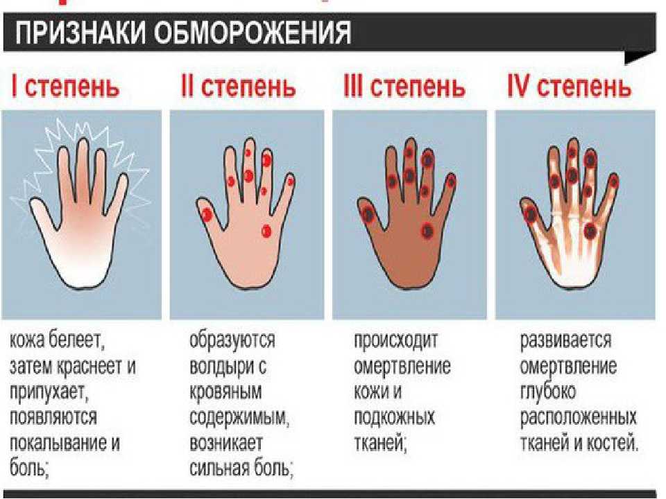 Ожог - причины и признаки ожога