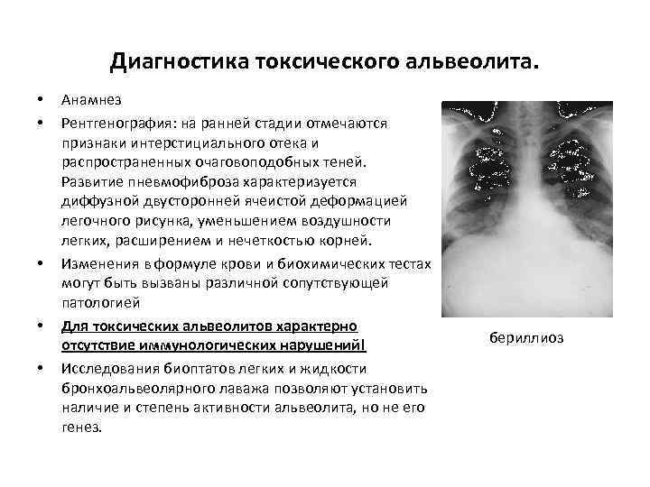 Альвеолит после удаления зуба: фото, лечение, симптомы