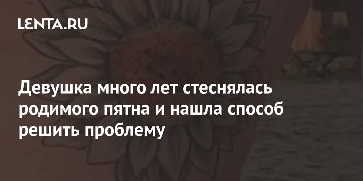 Родимые пятна - что это такое, как и откуда они появляются: чем опасны на теле человека, причины появления и от чего они берутся