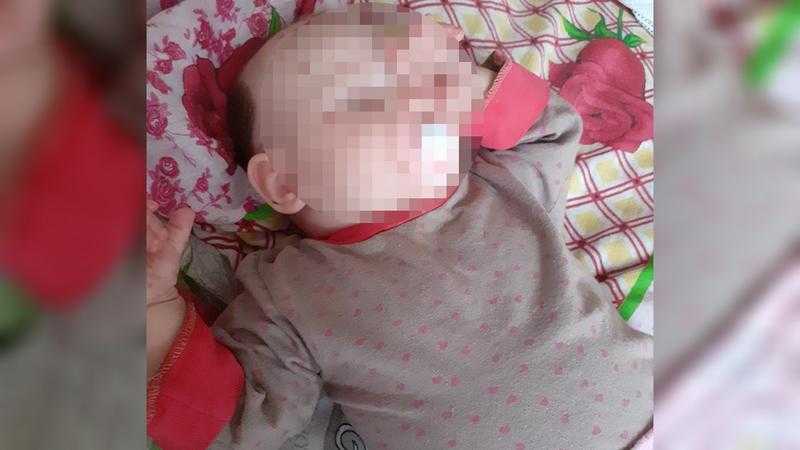 Родимые пятна - что это такое, как и откуда они появляются: чем опасны на теле человека, причины появления и от чего они берутся