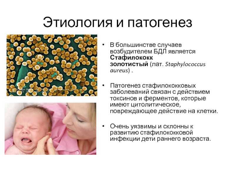 Золотистый стафилококк на коже, фото, симптомы и признаки