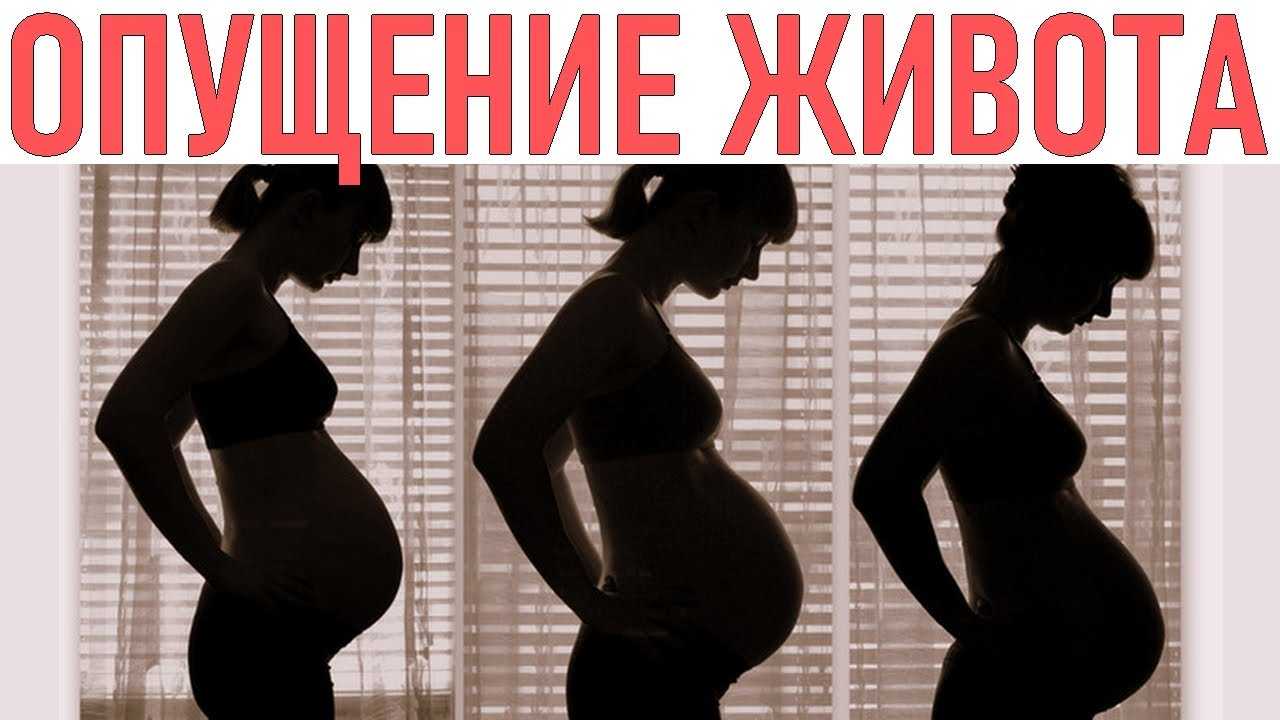 Всегда ли опускается живот перед родами?