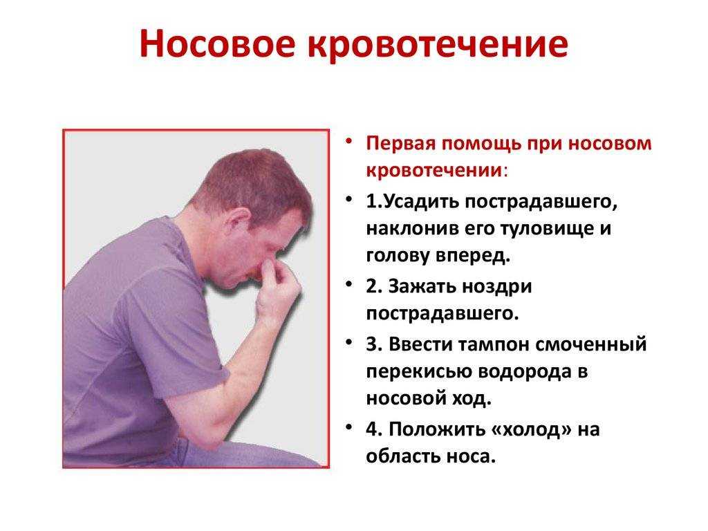 Кровь из носа у ребенка причины (4, 5, 6, 7, 8 лет): почему часто течёт ночью - лечение