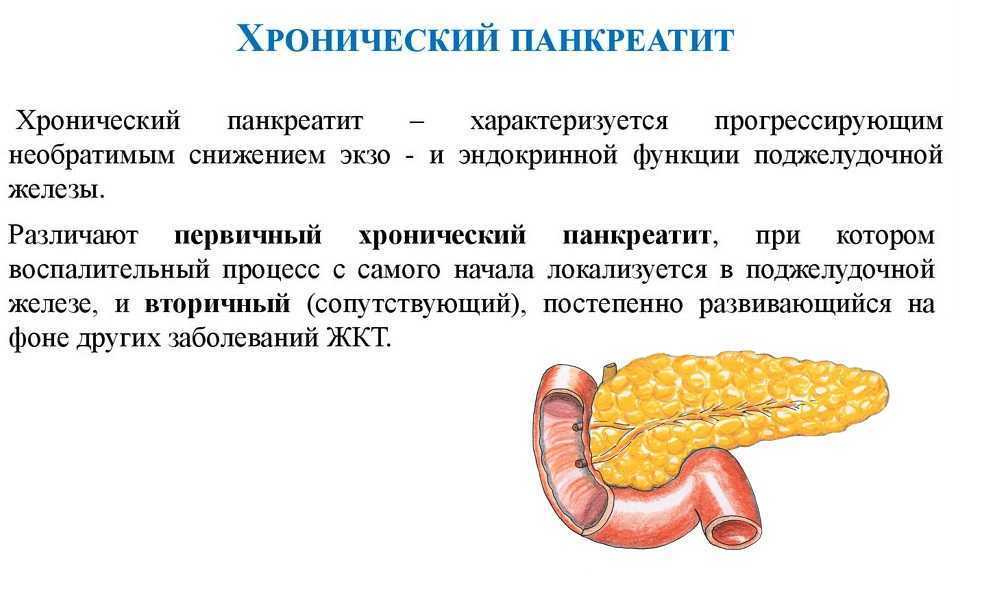 Сколько живут с хронический панкреатит